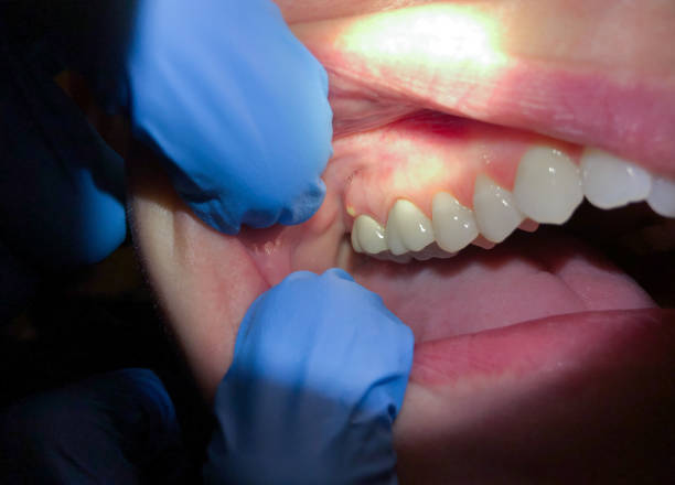 Best Emergency Cosmetic Dentistry (e.g., broken veneers) in East Flat Rock, NC
